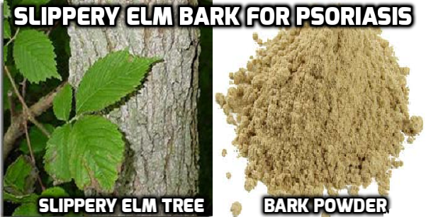 SLIPPERY ELM & PSORIASIS