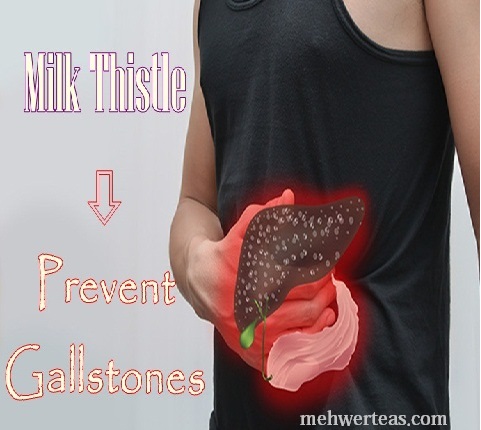 prevent-gallstonesBy Milkthistle